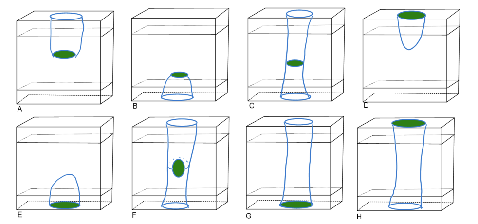 Exmples of structures